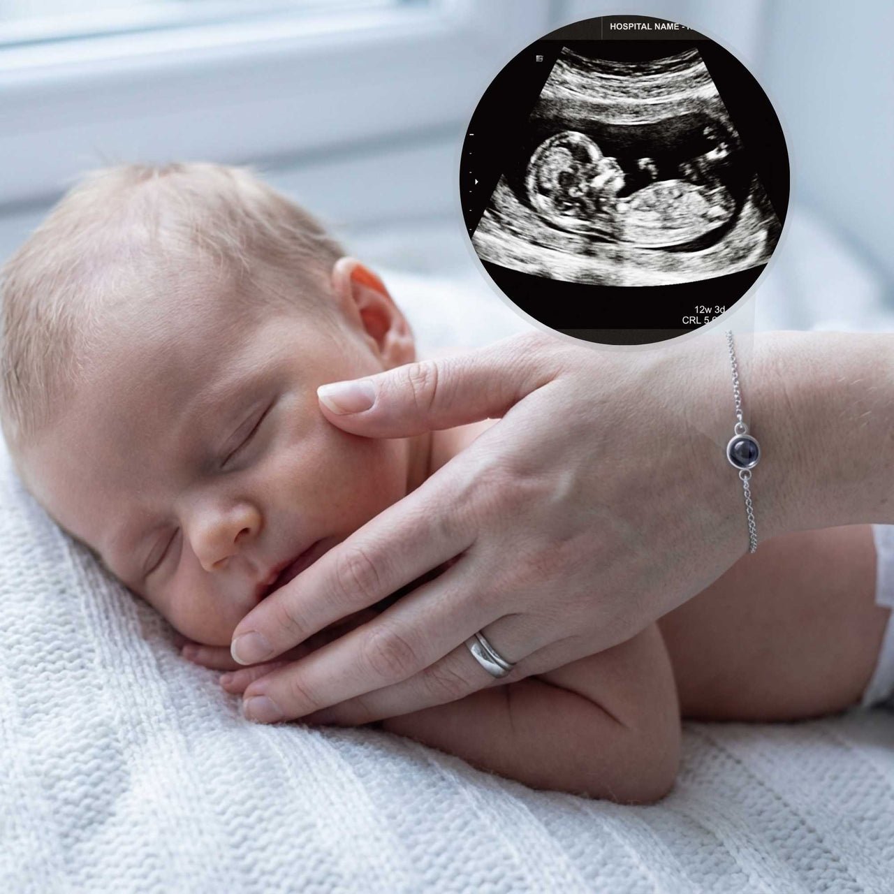 Bracelet Photo | De l'Échographie à Ses Premiers Pas