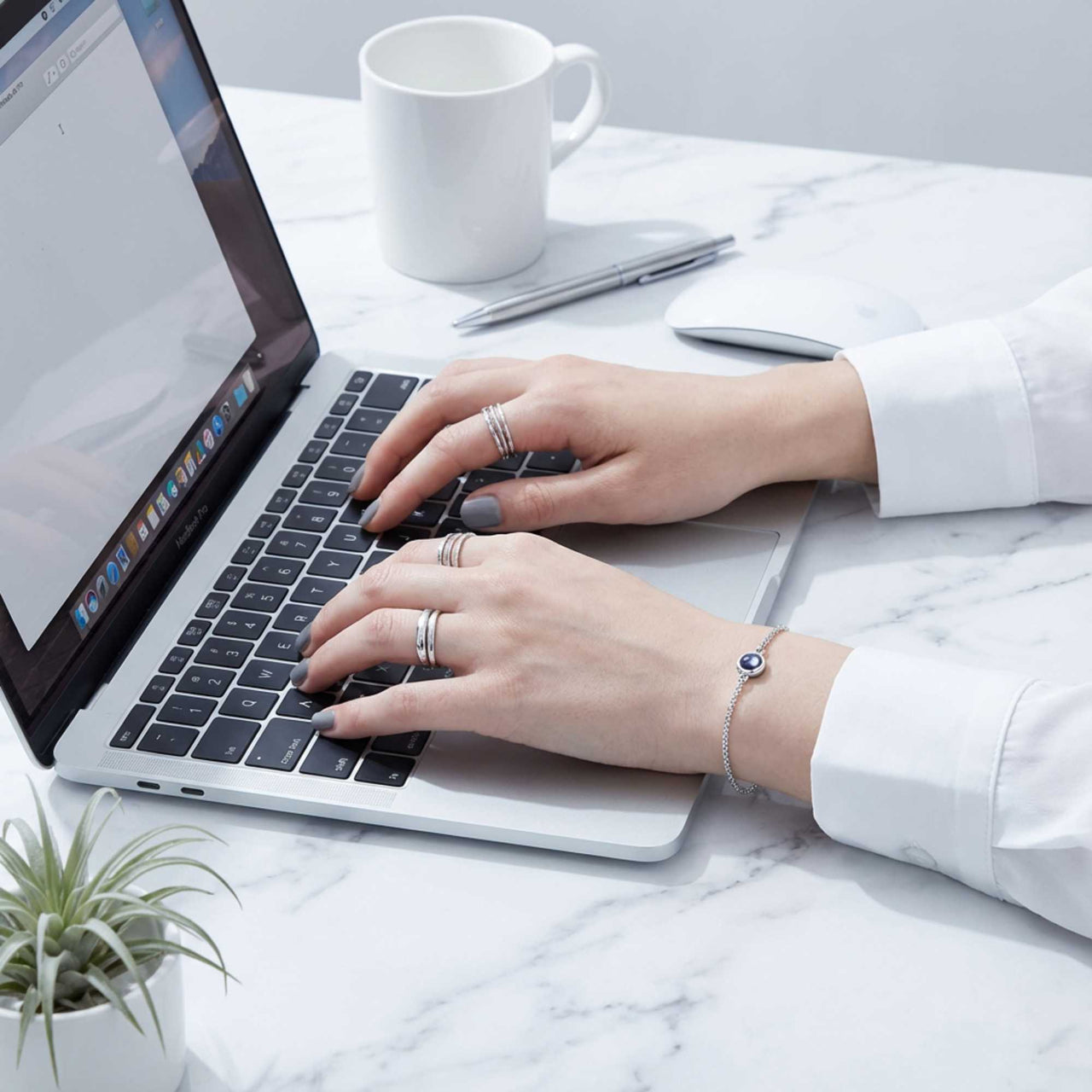 Bracelet Photo | De l'Échographie à Ses Premiers Pas